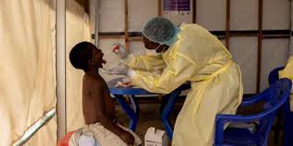 Mpox: l’agence de santé de l’Union africaine déclare «une urgence de santé publique»